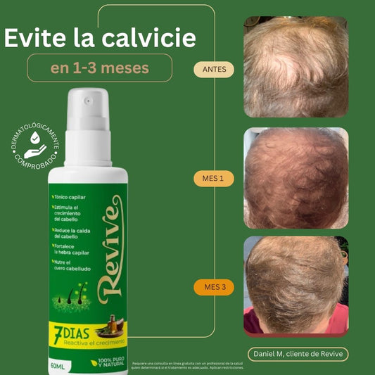 TÓNICO CAPILAR DE CRECIMIENTO REVIVE®